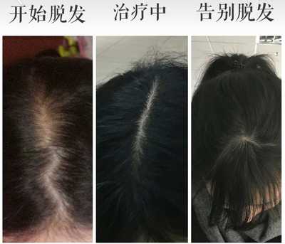 美丽