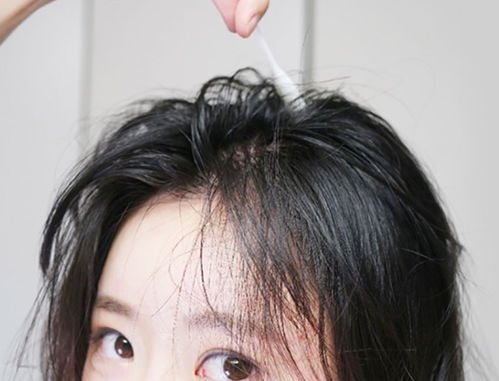 女人掉头发厉害怎么办