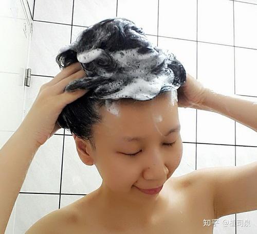 脂溢性脱发吃什么药 治疗脱发的最好方法