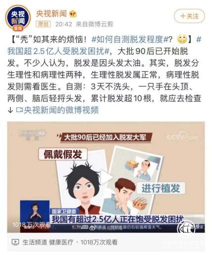 年轻人为何频脱发 长沙新生植发专家科普科学治脱如何做