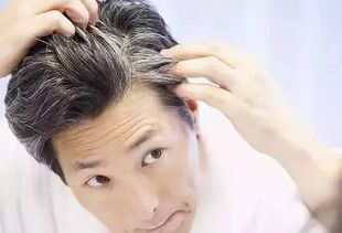 治疗脱发方法看的都烦了,上个绝招,让头发变浓密
