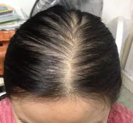 没想到头发这么做,对人影响这么大 男女必看