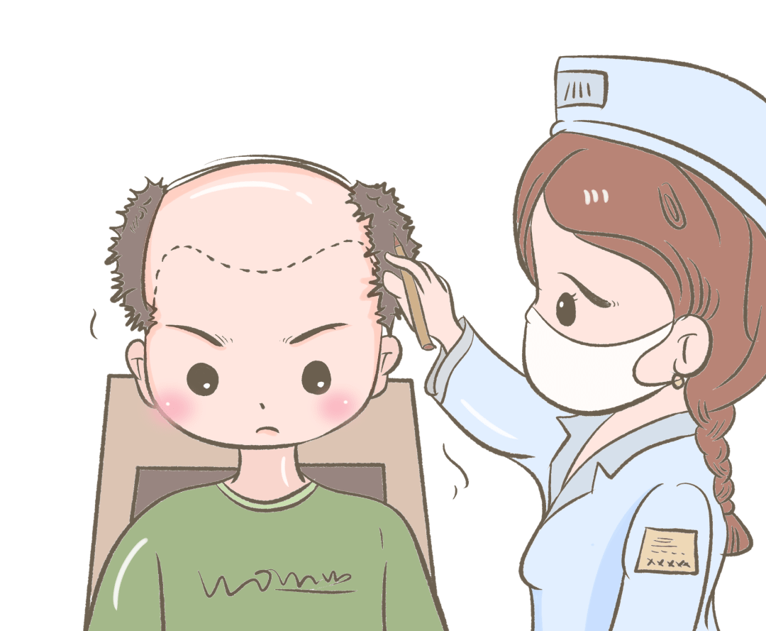 京城药师 | “雄激素性脱发”如何治疗?