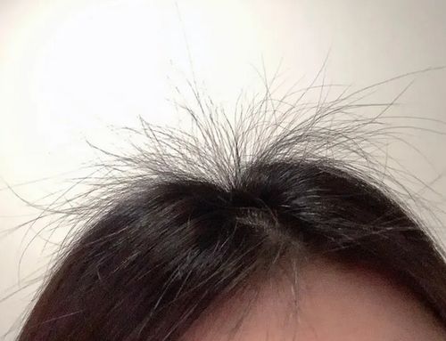哪种洗发水防脱发增发密发 平价党里的尖子生