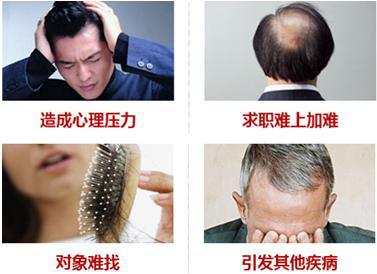 生发加盟书
