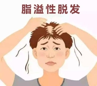 想要解决脂溢性脱发?找到根本原因是关键