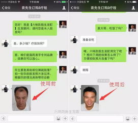 脱发白发怎么办 教你如何快速解决 头顶大事 网络疯传,值得收藏