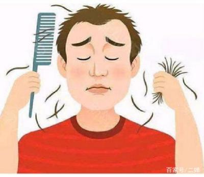 男性脱发的分期介绍