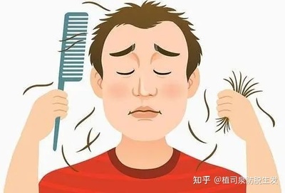 引起脱发的原因主要有哪些?脱发患者不可不知!