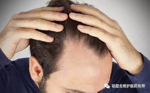 民间实用偏方:专治脱发白发
