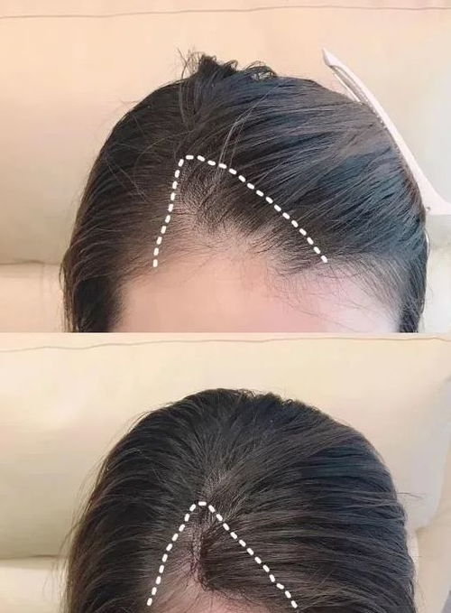 什么牌子洗发水防脱发生发效果好 世界十大防脱生发产品排行榜