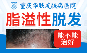 重庆脂溢性脱发的治疗医院