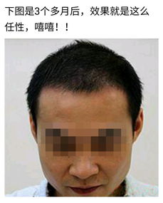 白发脱发如何食疗