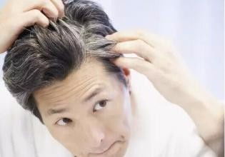 治疗脱发白发秘方