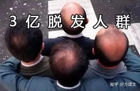 为什么脱发一定要趁早治疗?