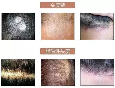3天不洗头也不油！海盐洗发膏 拯救大油头、头皮屑，柔顺秀发的终极方案