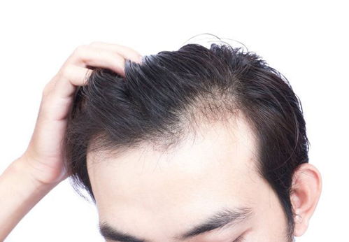 防脱生发，讲真话有那么难吗？治疗脱发的真相与迷思